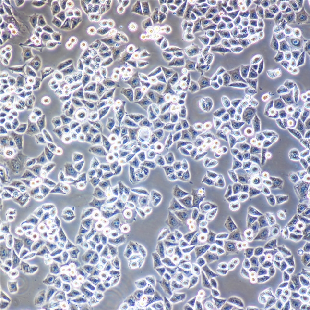 HCC-78 人肺腺癌细胞