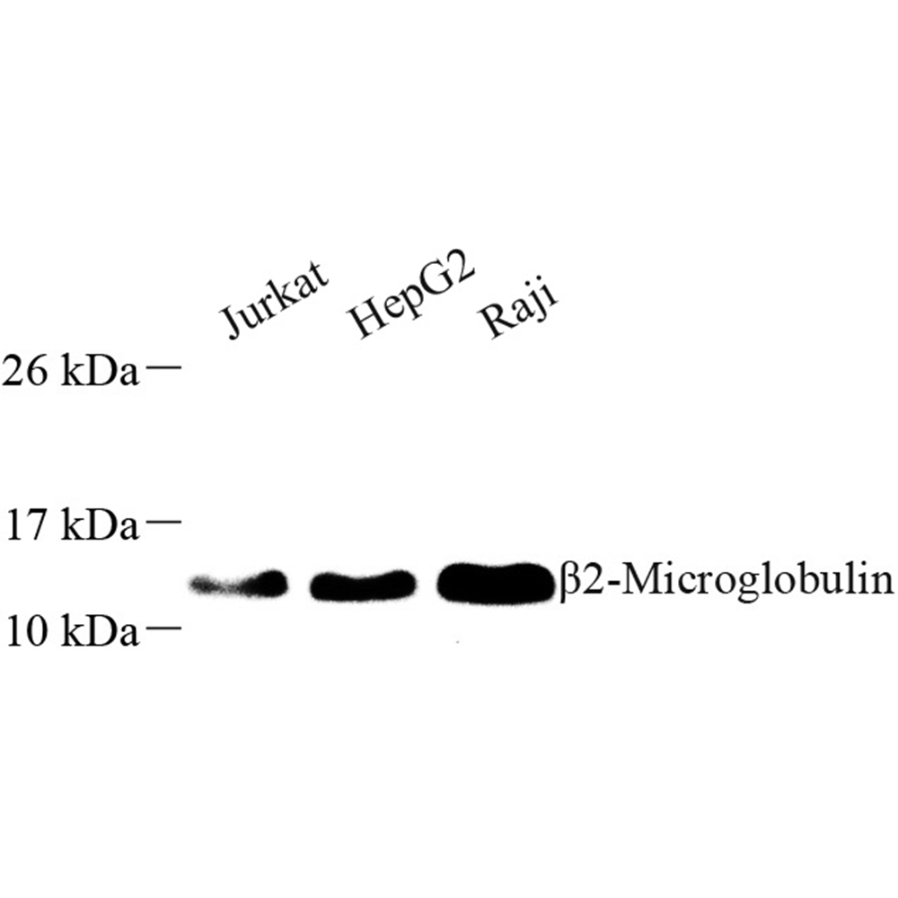 Anti -beta 2 Microglobulin Rabbit pAb